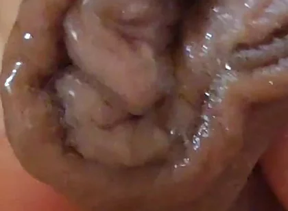 Large Foreskin and Balls in Striking Close-up.