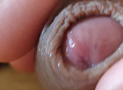 Large Foreskin and Balls in Striking Close-up.