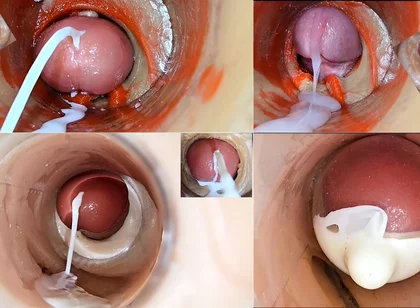 Cumfeti Dripping Creampie Compilation- Endoscopy View