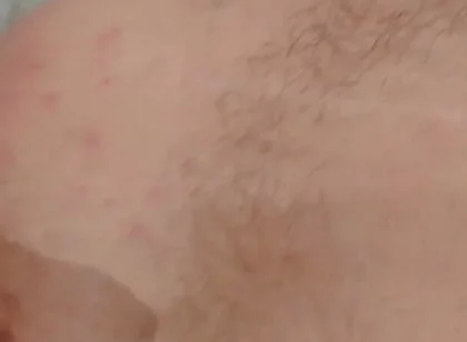 Masturbation