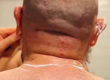 Shave Bald Head and Worship