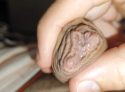 Silent Purge of Straight Scrotal Fluid.