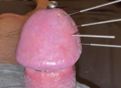 Needles Through the Thick, Hard Glans, Mega Orgasm