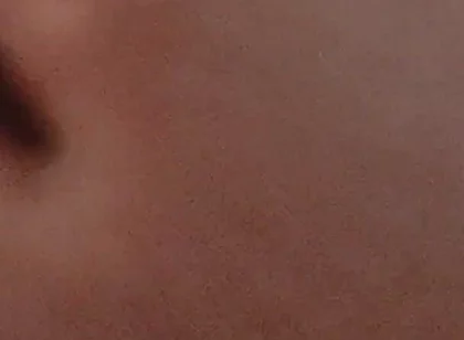 Amazing Closeup of the Widened Hole!!