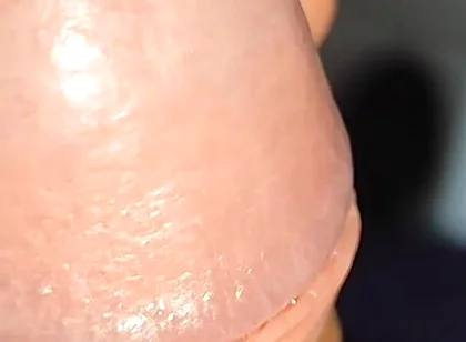 Extreme Application to the Syringe Inside the Glans!!