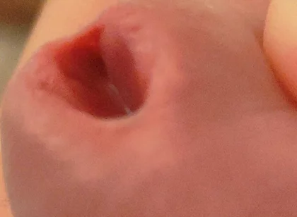 Amazing Closeup of the Widened Hole!!