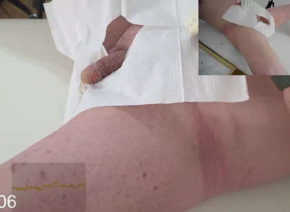 16 French Foley Insertion
