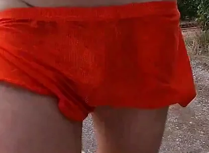 This Is What Happens When I Wear Shorts
