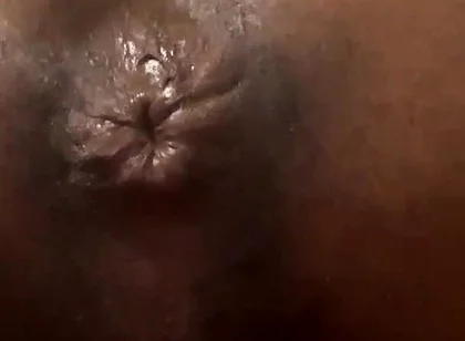 Talking About My Butt Hole