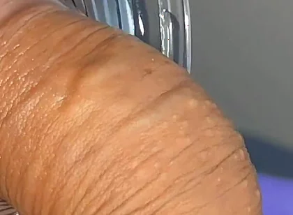 Mysterious Solution Inserted Into the Wrinkled Cock.