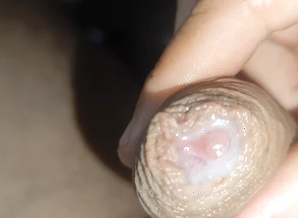 I Have the Largest Ejaculating Phimosis in the World!!