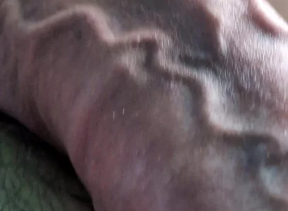 Throbbing