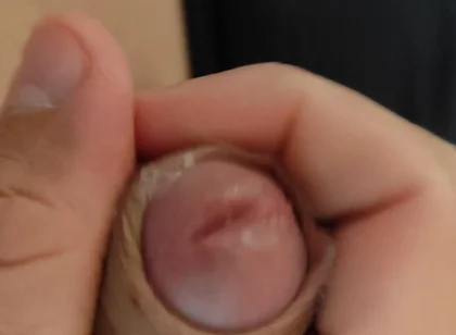 Amazing Pre Cum Glans.