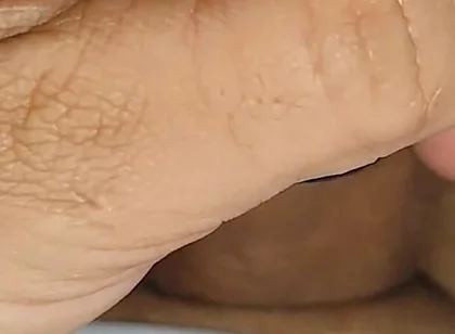 Electrical Pulsation Within the Glans with Rapid Excitation.