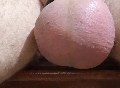 Saline and Masturbation