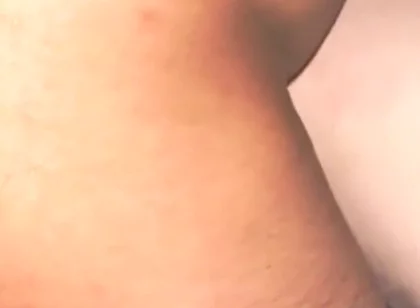 Smooth Skin