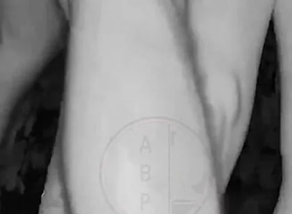 In a Park, at Night, Jules Is Desperate to Pee and Tries to Hide From His Friend but Is Caught on Night Vision Cam