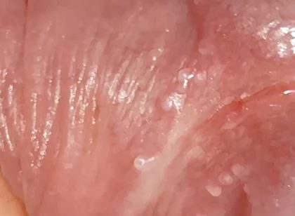 Wide Hole Filled with Pre Cum in Close up