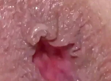 Extreme Closeup Dildo Anal Creampie