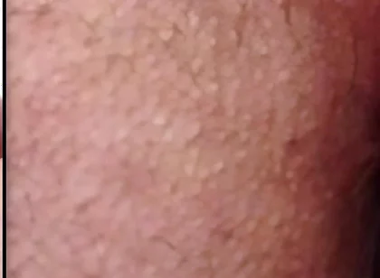 Split-screen Twitching Asshole Dripping with Massive Cum Load