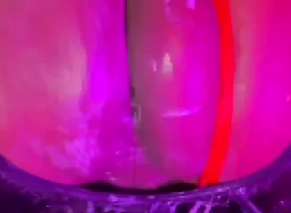 Why Yo Butt so Big?