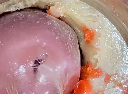 The Camera 4K Inside the Deep Pussy Records a Huge Ejaculation with a Stuck Condom