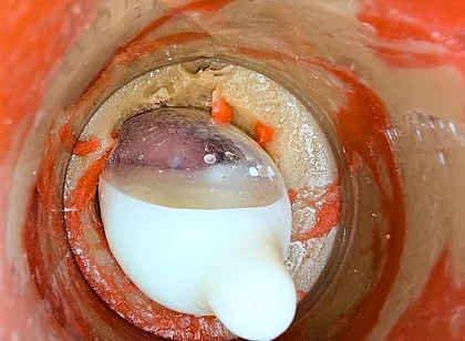 The Camera 4K Inside the Deep Pussy Records a Huge Ejaculation with a Stuck Condom