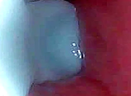 I Couldn’t Believe What Happens Inside the Penis as Sperm Passes Through (endoscopic Footage)