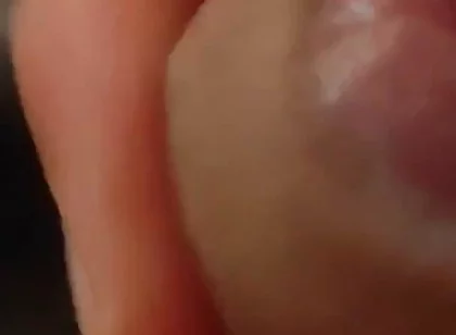Great Phimosis Getting in the Way of the Boy's Orgasm
