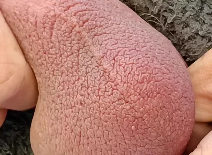 Big Uncut Cock Edging and Cumming, Outdoor Onesie Wank for the Neighbours - Rockardglans