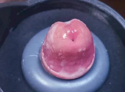 Penis Machine with a New Attachment