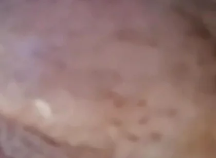 Extreme Fillings Inside My Siliconemeat