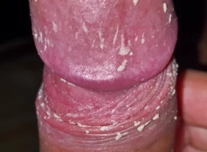 Checking My Dirty Dick