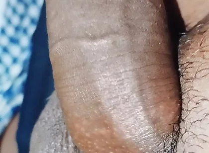 Penis
