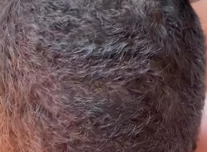 More Sucking