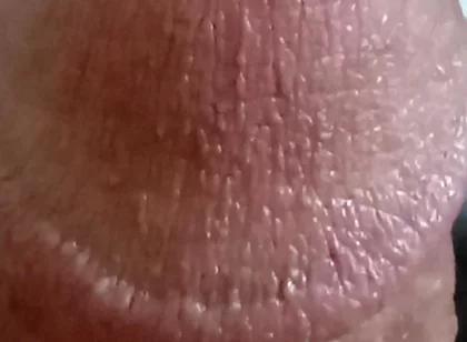 My Dick