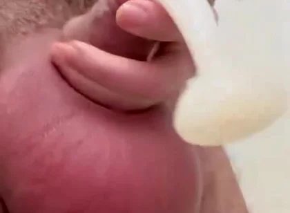 Inflated Ball Sack with Saline