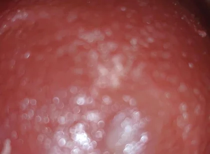 Deep Thrusts Trigger Feverish Cum Inside Without Sperm's Trace