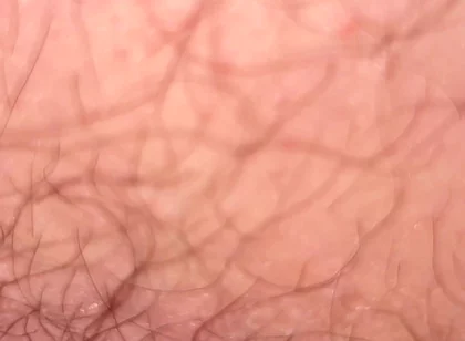 Close up Hairy Hole