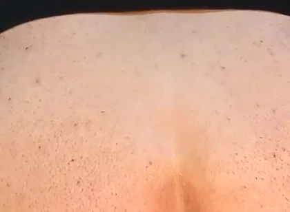 He Enjoys Sucking on His Anal Prolapse