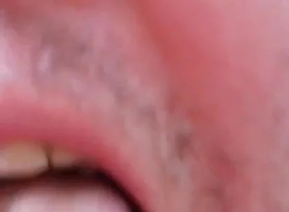 Camera Blunder in the Attempt at Facial Insemination