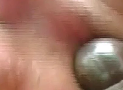 Gaping Anal Rosebud Prolapsing After Deep Stretching Session