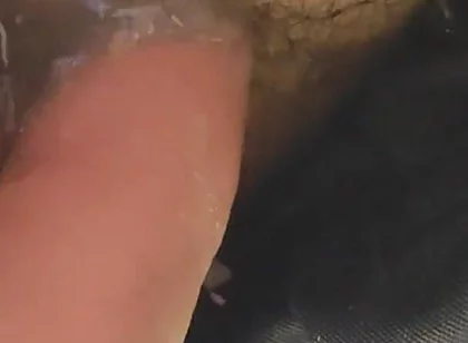 Uncircumcised Phimosis Has the First Ejaculation.