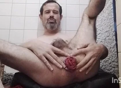 My Prolapse April 2026