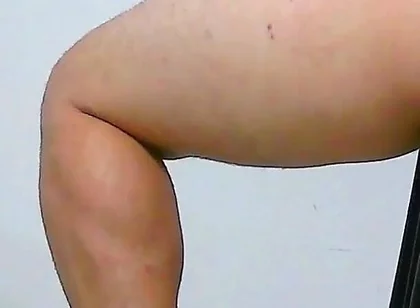 Oh, My Ass Hurts, Apply Ointment