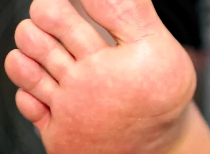 Golden Foot Bath for Pigs