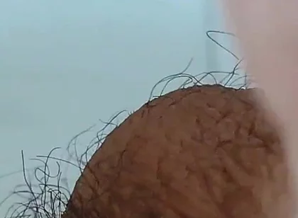 Extreme Open Hole Leaves the Glans Exposed.