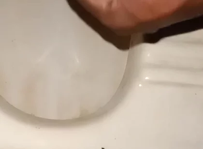 Urinating From the Penis