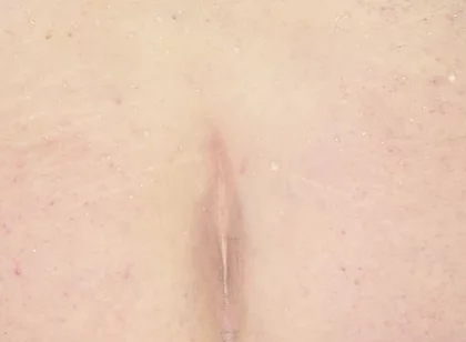 How I Stretch My Asshole for Fisting