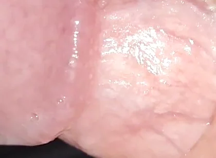 Incredible Cock, Unique of Slippery Phimosis by the Robust Body.